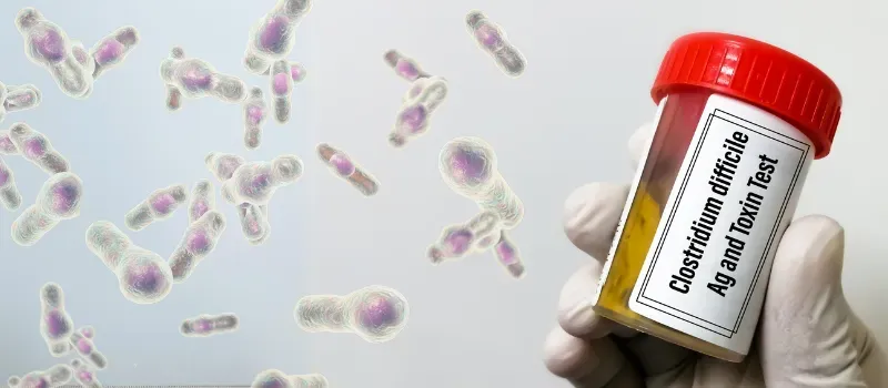 Como diagnosticar infecção por Clostridioides difficile?