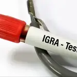 Diferenças entre IGRA e PPD