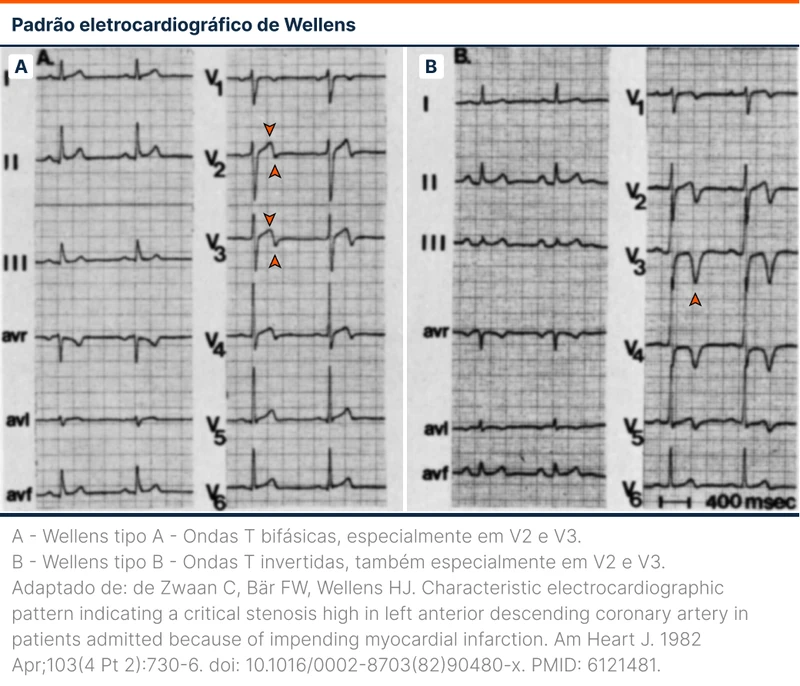 Padrão eletrocardiográfico de Wellens