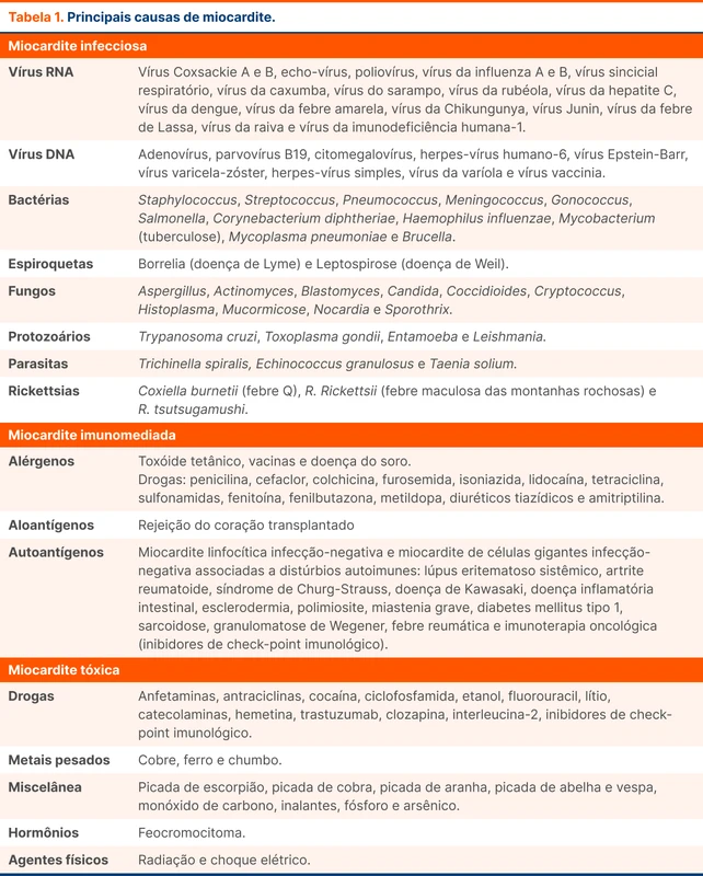 Principais causas de miocardite