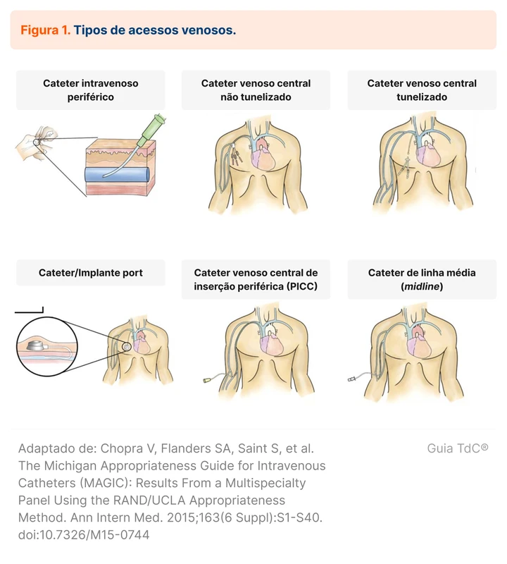 Tipos de acessos venosos