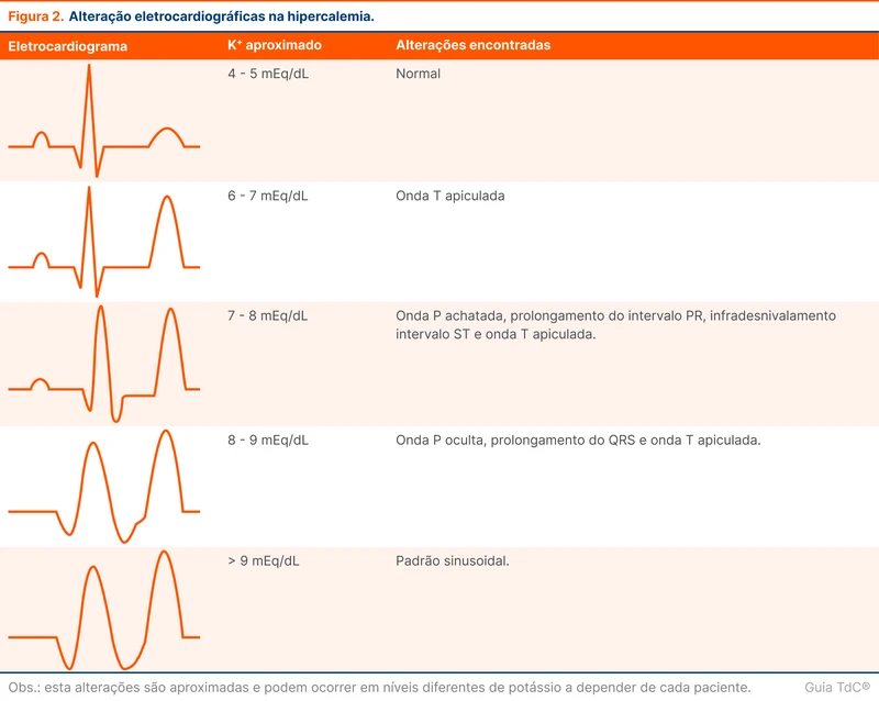 Alteração eletrocardiográficas na hipercalemia.