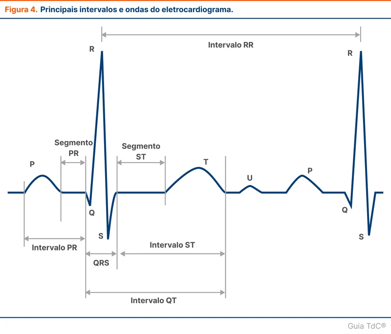 Principais intervalos e ondas do eletrocardiograma.