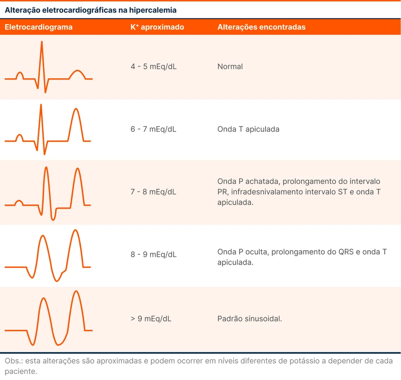 Alteração eletrocardiográficas na hipercalemia