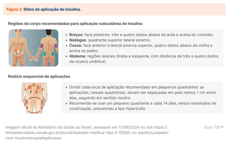 Sítios de aplicação de insulina