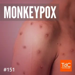 Episódio 151: MonkeyPox