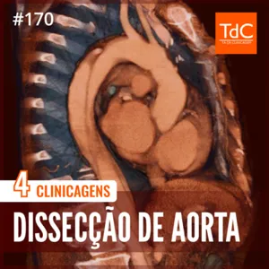 Episódio 170: Dissecção de Aorta - 4 Clinicagens